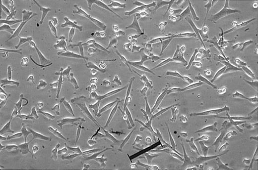 Figure 1. Morphology of single cell-derived, clonally expanded UCB MSCs. The lineage-depleted mononuclear fraction was plated in culturing medium, culture expanded, and plated at a density of 30 cells/96-well plate. Single cell-derived clones were then culture expanded and maintained between 30% and 60% confluence. Original magnification, × 100. Scale bar indicates 100 μm.