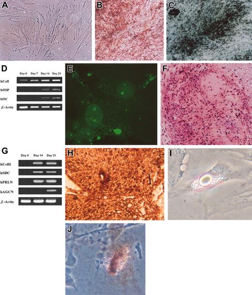 Figure 3. Osteogenic, chondrogenic, and adipogenic differentiation from UCB MSCs. Osteogenic differentiation evidenced by morphology of cells after 9 days of induction (A), formation of mineralized matrix shown by Alizarin red (B), and von Kossa staining (C) and by the expression of bone-specific genes over 3 weeks of induction (D). Osteoblastic differentiation was further confirmed by immunofluorescence staining for osteopontin after 21 days of induction (E). Chondrogenic differentiation was evidenced by safranin-O staining (F), by the expression of chondrocyte-specific genes (G), and by immunohistochemical staining for type II collagen (H). Adipocytic differentiation was evidenced by the formation of lipid vacuoles in phase-contrast photograph (I) at original magnification × 200 and by oil-red O staining (J) shown at original magnification × 100. Original magnification, × 100 (A-C, E-F, H). Scale bar in panel H indicates 100 μm.