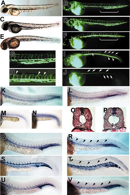 Figure 1. syndecan-2 MO–injected embryos showed angiogenic defects. (A) An uninjected wild-type embryo at 48 hpf. (B) Microangiogram of an uninjected wild-type embryo at 48 hpf. Bright field image (C) and microangiogram (D) of an embryo injected with 5 ng of a 4-base mismatch syndecan-2 showing intact vasculature. (E) An embryo injected with 5 ng syndecan-2 MO1, showing no obvious morphologic defects at 48 hpf. (F,I,J) Microangiograms of embryos injected with 5 ng syndecan-2 MO1, showing vascular phenotypes (frequency: 84% ± 4%, n = 55). Magnified images of sections indicated by brackets in panels B and F are shown in panels G and H, respectively. Embryos injected with syndecan-2 MO1 showed either aberrant (F; arrowheads in H compared with wild-type in G) or reduced intersegmental vessels (I, arrows) and reduced tail vessels (I, arrowheads). In the most severe case, embryos showed a complete lack of intersegmental vessels (top arrows in J) and lack of tail vessels (bottom arrows in J). In situ analysis was also performed to assess molecular phenotypes of syndecan-2 MO–injected embryos. (K-L) Expression of ephrin-B2 in a wild-type embryo (K) and a syndecan-2 MO–injected embryo (L) at 24 hpf. Arterial expression of ephrin-B2 was retained in syndecan-2 MO–injected embryos. (M-N) Expression of VEGF-A in wild-type (M) and syndecan-2 MO–injected (N) embryos (n = 20). Somitic expression of VEGF-A was not affected in syndecan-2 MO–injected embryos. Cross sections from the anterior trunk of a wild-type embryo (O) and a syndecan-2 MO–injected embryo (P) at 44 to 48 hpf stained with hematoxylin and eosin. The dorsal aorta (top arrowhead) and the axial vein (bottom arrowhead) were both observed in syndecan-2 MO–injected embryos. (Q) Expression of fli-1 in a wild-type embryo at 24 hpf. (R) A syndecan-2 MO–injected embryo at 24 hpf, showing a lack of intersegmental fli-1 expression (arrowheads). Of the embryos, 58% (n = 35) showed reduced intersegmental fli-1 expression at 5 ng syndecan-2 MO1. (S) Expression of flk-1 in a wild-type embryo at 24 hpf. (T) A syndecan-2 MO–injected embryo at 24 hpf, showing a lack of intersegmental flk-1 expression (arrowheads). Of embryos, 50% (n = 40) showed reduced flk-1 expression at 5 ng syndecan-2 MO1. (U) Expression of tie-1 in a wild-type embryo at 24 hpf. (V) A syndecan-2 MO–injected embryo at 24 hpf, showing a lack of intersegmental expression of tie-1 (arrowheads). At 5 ng syndecan-2 MO1, 63% of embryos (n = 56) showed reduced tie-1 expression. (A,C,E) Bright field images (original magnification, × 5). (B,D,F-J) Microangiography analysis (original magnification, × 5. (K-N,Q-V) In situ hybridization (original magnification, × 10). (O-P) Original magnification, × 40.