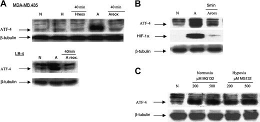 Figure 3. Reoxygenation of anoxic cells results in a decrease in ATF-4 protein level, and proteasome inhibition results in an increase in ATF-4 protein level. (A) MDA-MB 435 and LB-4 cells were incubated for 16 hours in normoxia, hypoxia, or anoxia. After 16 hours, anoxic cells (or hypoxic cells, as in the case of MDA-MB 435 cells) were then immediately placed in a normoxic incubator for 40 minutes. This reoxygenation (reox.) of anoxic MDA-MB 435 and LB-4 cells resulted in the down-regulation of ATF-4 protein levels. Reoxygenation of hypoxic MDA-MB 435 cells did not affect the level of ATF-4 protein compared with hypoxic cells. (B) MDA-MB 435 cells were incubated for 16 hours in anoxia, after which the anoxic media of the cells were replaced with normal fresh media (oxygenated), and the cells were incubated in a normoxic incubator for 5 minutes. Cells were then analyzed by immunoblot for ATF-4 protein level. (C) MDA-MB 435 cells were incubated in normoxia for 16 hours, after which 200 or 500 μM (end concentration) of the proteasome inhibitor MG132 was added directly to the cells. Cells were incubated another 16 hours in normoxia or hypoxia and then analyzed using immunoblot for ATF-4 protein levels. N indicates normoxia; H, hypoxia; A, anoxia.