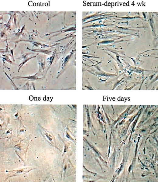 Figure 1. Phase contrast micrographs of hMSCs during and after selection for SD cells. (Top row) Before recovery of SD cells. (Bottom row) After recovery of SD cells. Passage 2 hMSCs were incubated in complete medium containing 17% FCS for 28 days with a change of medium every 4 days to obtain control cells. Parallel hMSC cultures were incubated under the same conditions in medium without serum to obtain SD cells. The SD cells were then recovered by incubation in medium with 17% FCS for 1 to 5 days. Original magnification, × 10.