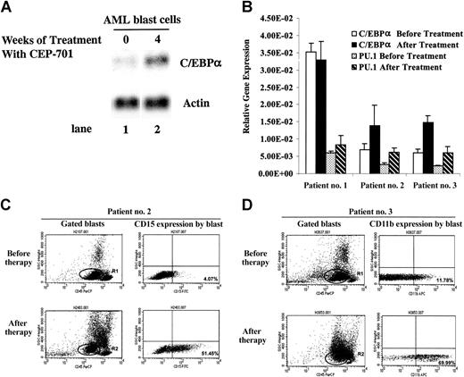 Figure 3. Inhibition of FLT3 kinase activity leads to an up-regulation of C/EBPα and PU.1 and an increase in the expression of differentiation markers in blasts of 2 of 3 FLT3/ITD-positive AML patients. (A) AML bone marrow blasts were collected before and after 4 weeks of treatment with CEP-701 from a FLT3/ITD-positive AML patient who was enrolled in the CEP-701 clinical trial and whose bone marrow blasts did not decrease with therapy. Total cellular RNA was prepared and 7 μg from each sample was subjected to sequential Northern blotting with a 0.7-kb EcoRI-HindIII fragment of human C/EBPα cDNA17 and actin cDNA probe. (B) Bone marrow blasts were obtained before and after 2 or 4 weeks of treatment with CEP-701 from 3 FLT3/ITD-positive AML patients whose bone marrow did not show a decrease of blasts in response to therapy. C/EBPα and PU.1 mRNA expression were analyzed using real-time RT-PCR analysis. Levels of C/EBPα and PU.1 were expressed relative to actin. Error bars indicate SD. (C-D) Bone marrow blasts were collected prior to and after 2 or 4 weeks of treatment with CEP-701 from 2 FLT3/ITD-positive AML patients. Antigen expression profiles of these blasts were determined by multiparameter flow cytometric analysis. AML blasts, characterized by low side-scattering value and expression of CD45, CD117, and CD33 (data not shown), were specifically gated (left). Expression of CD15 or CD11b by these blasts was then analyzed (right).