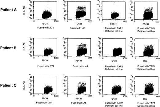 Figure 1. The reduction in class I MHC expression is due to TAP2 deficiency. Fusion of EBV-A, EBV-B, and EBV-C with various B-cell lines defective either for the TAP1 and TAP2 subunits (.174) or none of them (.45). Total mixture of cells was analyzed by FACS. Fused cells were identified by HLA-A3 expression. Staining with HLA-A3 is on the y-axis, and forward scatter is on the x-axis. One representative experiment is shown of 3 performed.