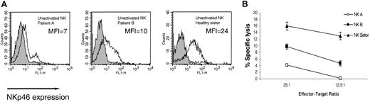 Figure 2. Impaired expression and function of NKp46 on freshly isolated NK cells. (A) NKp46 expression on freshly isolated bulk NK cells. Staining was detected by mAb 461-G1 in the form of F(ab′)2, and the MFI staining is indicated in each histogram. One representative experiment is shown of 3 performed. (B) Killing of .221 cells by freshly isolated NK cells derived from indicated donors. The mean results of 3 independent experiments are shown. The data represent means of the percentage of killing ± SDs.