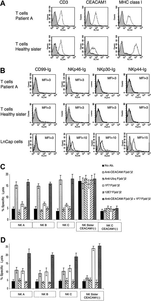 Figure 4. Killing of PHA-induced T-cell blasts. (A) Staining of PHA-induced T-cell blasts with various mAbs. Staining of PHA-induced T-cell blasts derived from patient A and from the healthy sister was performed with the F(ab′)2 fragments of anti-CD3, anti-CEACAM1, and anti–MHC class I mAb HP-1F7. (B) Staining of PHA-induced T-cell blasts and of the LnCap cell line with various fusion proteins. Staining was performed with the NKp46-Ig, NKp30-Ig, NKp44-Ig, and the control CD99-Ig fusion proteins. (C) NK clones derived from patients A, B, and C were assayed for cytotoxic activity against autologous PHA-induced T-cell blasts. The NK clones obtained from the healthy sister were assayed against PHA-induced T-cell blasts derived from patient A. NK clones were preincubated with or without F(ab′)2 fragments of polyclonal anti-CEACAM or the control polyclonal antiubiquitin antibodies. The targets, autologous PHA-induced T-cell blasts, were incubated with or without the F(ab′)2 fragments of HP-1F7 or the control 12E7 mAb. Assays were performed at an E/T ratio of 2:1. Shown are the mean results of several NK clones that were obtained from 3 independent experiments. The data represent the mean percentage of killing ± SD. (D) NK clones derived either from the healthy sister or from patients A, B, and C were assayed for killing of PHA-induced T-cell blasts derived from the healthy sister. NK clones and target PHA-induced T-cell blasts were pretreated as described for panel C. Assays were performed at an E/T ratio of 2:1. Shown are the mean results of several NK clones that were obtained from 3 independent experiments. All mAbs used were in the form of F(ab′)2. The data represent the mean percentage of killing ± SD.
