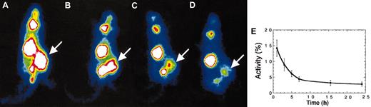 Figure 3. In vivo iodide retention by tumor cells infected with MV-NIS. (A) MM1 tumors infected with MV-NIS concentrate iodide and retain it for at least 24 hours. At 9 days after intravenous injection of MV-NIS, mice were imaged serially at 1 (A), 3 (B), 5 (C), 7 (D), 15, and 24 hours after 123I injection. Images A-D were all acquired over 5 minutes and are adjusted for the same image intensity. (E) Quantification of iodide uptake and retention by MM1 tumors after infection with MV-NIS. MM1 tumors take up 12% to 17% of the isotope injected and retain it for at least 24 hours. Error bars indicate SD. Magnification is 0.55 mm per pixel.