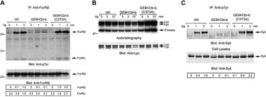 Figure 5. Overexpression of GEM-Cbl-b suppresses tyrosine phosphorylation of FcϵRI and Syk. (A) Control cells and cells overexpressing GEM-Cbl-b were primed with anti-DNP IgE and then stimulated with 30 ng/mL antigen DNP-BSA for the indicated times. Cell lysates (3 × 106 cells) were solubilized in 1% Triton lysis buffer and immunoprecipitated with anti-FcϵRIβ mAb. The immunoprecipitates were separated by SDS-PAGE and analyzed by the immunoblotting with anti-pTyr mAb, anti-FcϵRIβ mAb. (B) Cells were solubilized in 1% Triton lysis buffer and immunoprecipitated with anti-Lyn antibody.Anti-Lyn immunoprecipitates were subjected to the in vitro protein kinase assay by using enolase as an external substrate. Radiolabeled proteins were separated by SDS-PAGE and visualized by autoradiography. Immunoprecipitated Lyn was analyzed by immunoblotting with anti-Lyn antibody. (C) Cells were solubilized in the denature buffer and immunoprecipitated with anti-pTyr mAb. The immunoprecipitates and detergent-soluble cell lysates were analyzed by the immunoblotting with anti-pTyr mAb and anti-Syk antibody. The numbers at the bottom of the figures are the normalized densitometric analysis of FcϵRIβ,FcϵRIγ, and Syk phosphorylation. Similar results were obtained when the other cloned lines were examined. The results were representative of 5 experiments.