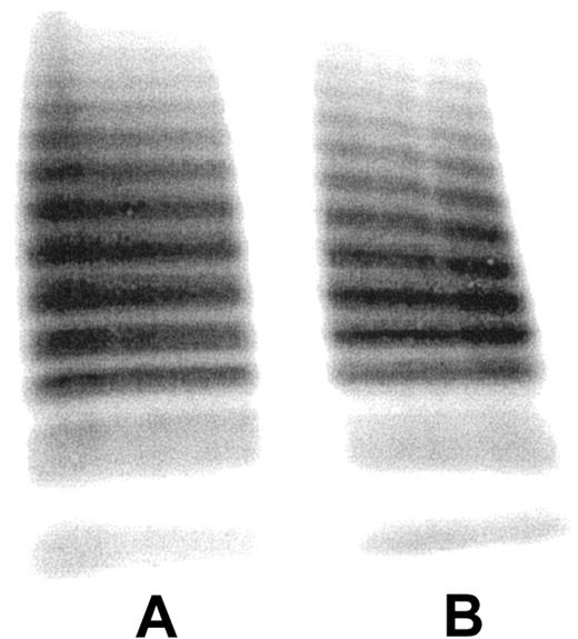 Figure 2. Multimeric composition of fibrin-bound VWF. 125I-VWF (lane A) and SDS-eluted fibrin-bound 125I-VWF (lane B) from 15 spin-X tubes were subjected to SDS-agarose electrophoresis. Gels were loaded with approximately 1 μg protein.