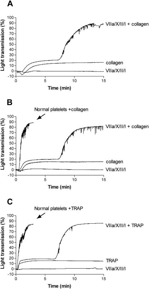 Figure 1. Aggregation of αIIbβ3-deficient or αIIbβ3-inhibited platelets by rFVIIa-mediated fibrin formation. Washed platelets from a patient with GT (A) or platelets from healthy volunteers pretreated with dRGDW for 5 minutes (200 μM; B-C) were activated with collagen (4 μg/mL; A-B) or TRAP (15 μM; C), a mixture of factors VIIa (1.2 μg/mL), X (10 μg/mL), II (20 ng/mL), and fibrinogen (0.5 mg/mL), or with collagen or TRAP in combination with the coagulation factors, all in the presence of 3 mM CaCl2. Platelet aggregation was monitored using standard suspension aggregometry at 37°C using a stir speed of 900 rpm. In panels B and C, aggregation of washed platelets with collagen or TRAP in the absence of dRGDW is shown for reference. Panel A is a typical representation of experiments with 3 unrelated GT patients; panels B and C represent a typical representation of more than 10 experiments.
