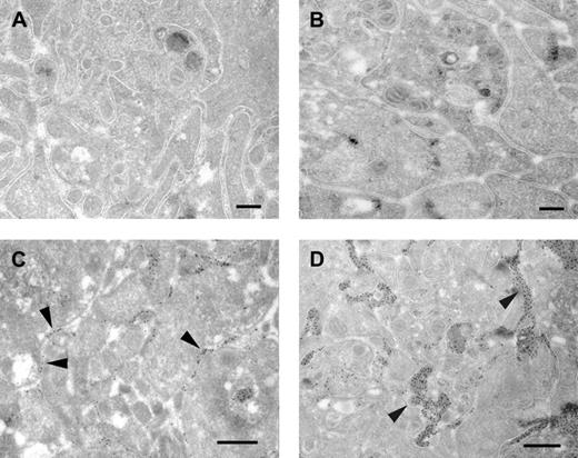 Figure 4. Ultrastructural analysis of αIIbβ3-dependent and -independent platelet aggregates. Washed platelets (A,C) or washed platelets pretreated with dRGDW (200 μM; B,D) were stimulated with collagen (A,C) or with collagen and coagulation factors VIIa, X, II, and I in the presence of calcium chloride (B,D) under stirring conditions (900 rpm) at 37°C. After 10 minutes of aggregation, samples were fixed and prepared for electron microscopy as described in “Materials and methods.” Samples were examined directly (A-B) or after immunogold labeling using an antibody against fibrin(ogen) followed by protein A–gold (C-D). Bars indicate 200 nm (A-B) and 500 nm (C-D).