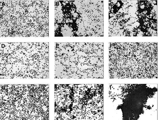 Figure 5. Microaggregate formation on stimulation of washed αIIbβ3-inhibited platelets by collagen. Platelets pretreated with dRGDW (200 μM) were stimulated with collagen (4 μg/mL; A-C) with purified coagulation factors VIIa, X, prothrombin, and fibrinogen (D-F) or with the combination (G-I) in an aggregometry setup as described in Figure 1. At time points 0 (A,D,G), 2 (B,E,H), and 10 minutes (C,F,I) samples were taken, fixed with glutaraldehyde, spun down on a glass coverslip, and stained with May-Grünwald/Giemsa. The coverslips were examined by light microscopy (original magnification, × 400).