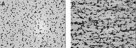 Figure 7. Aggregation of αIIbβ3-inhibited platelets under flow conditions induced by rFVIIa. Citrated whole blood was incubated with dRGDW (200 μM) in absence (A) or presence (B) of rFVIIa (2 μg/mL) for 5 minutes at 37°C. After addition of calcium chloride (5 mM), the blood was immediately perfused over a coverslip coated with collagen type III at a shear rate of 300 s–1 for 5 minutes at 37°C using a single-pass perfusion chamber. After perfusion, coverslips were fixed and stained with May-Grünwald/Giemsa and examined by light microscopy (original magnification × 400). Representative images of 3 independent experiments are shown.