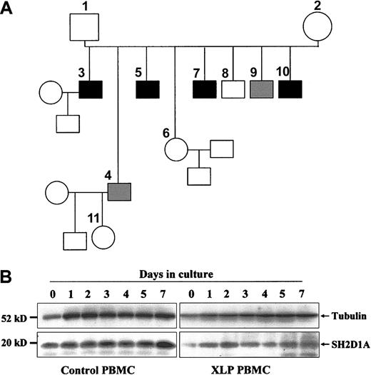 Figure 1. Family C (XLP) pedigree and genetic investigations. (A) ▪ indicates male members of the family who died of XLP-associated disease; ▦, surviving XLP patients; and □ or ○, unaffected members. Female members 2 and 11 are obligate heterozygous for the XLP deficiency. (B) PBMCs obtained from a healthy control and from patient 9 were stimulated with phytohemagglutinin (PHA, 1 μg/mL) for the indicated times. After stimulation, whole-cell lysates were evaluated by Western blotting using anti-SH2D1A antibody. In normal cells, SH2D1A protein levels increase gradually after stimulation. SH2D1A protein levels are decreased at baseline in patient 9 and fail to increase in response to PHA stimulation. (bottom panel) Dot-plot analysis of patient 9 and control (N) samples shown as an example.
