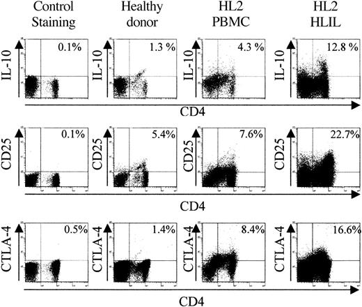Figure 3. Comparison of regulatory cell marker expression in healthy donor PBMCs and HL patient PBMCs, and HLILs. Staining for representative examples of healthy donor PBMCs (n = 4) and HL patient PBMCs (n = 9) and HLILs (n = 6). Plots show the percentage of lymphocytes staining positive for CD4 and IL-10, or CD4 and CD25, or the percentage of CD4+ lymphocytes staining positive for the costimulatory molecule CTLA-4. Cells were stained within 24 hours of purification and were unstimulated prior to staining. The control staining plots show the percentage of lymphocytes staining positive for CD4 and isotype control antibodies.