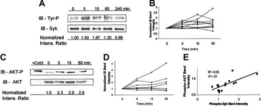 Figure 4. Ligation of HLA-DR by Hu1D10 promotes phosphorylation of both Syk and AKT. (A) CLL cells were treated with Hu1D10 plus antihuman Fc antibody (both 10 μg/mL) for the indicated times. Cells were immediately lysed, immunoprecipated (IP) with anti-Syk/protein A-G agarose beads. Immunoblotting of the IP product was performed with antityrosine antibody (monoclonal antibody 4g10). Gels were stripped and then reprobed with anti-Syk. A representative patient is shown here demonstrating an increase in Syk tyrosine phosphorylation following Hu1D10 treatment. Panel B summarizes the results from 10 different patient samples. The intensity ratios are determined from the ratio of 4g10 band intensity to the Syk band intensity. Values are normalized to the value at time zero. (C) CLL cells were treated with Hu1D10 plus antihuman Fc antibody (both 10 μg/mL) for the indicated times. Cells were immediately lysed and assessed for changes in AKT activity by determination of Ser473 phosphorylation through immunoblot analysis. A representative patient is shown here demonstrating an increase in phosphorylation of AKT following Hu1D10 treatment. The positive control is Jurkat cell lysate. Panel D summarizes the immunoblot data from 7 different patient samples. (E) Five samples were treated for 0, 5, 15, and 60 minutes with Hu1D10 plus antihuman Fc antibody (both 10 μg/mL). Using the techniques outlined, normalized ratios of Syk-P/Syk and AKT-P/AKT band intensities were determined for each sample at the noted times. For each sample at a given time point the value of the AKT-P and Syk-P ratio is plotted. By definition, the x, y values at time zero equals 1, so these values are not plotted. As indicated by the positive correlation coefficient (R2 = 0.53), phospho-AKT levels rise as phospho-Syk levels rise.