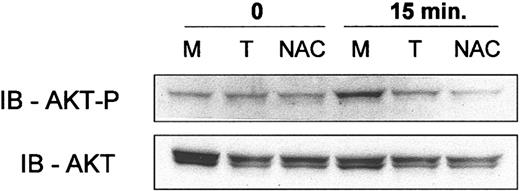 Figure 6. Antioxidants N-acetyl cysteine and tiron decrease Hu1D10 induced phosphorylation of AKT. CLL cells were treated as follows: (M) media only, (T) pretreatment with 10 mM tiron followed by Hu1D10 plus antihuman Fc antibody or (NAC) pretreatment with 25 mM N-acetyl cysteine followed by Hu1D10 plus antihuman Fc antibody (both 10 μg/mL). After a 15-minute treatment with cross-linked Hu1D10, the cells were lysed. Samples were immunoblotted using standard techniques. Blots were probed with anti–phospho-AKT (Ser473), stripped, and then reprobed with anti-AKT.