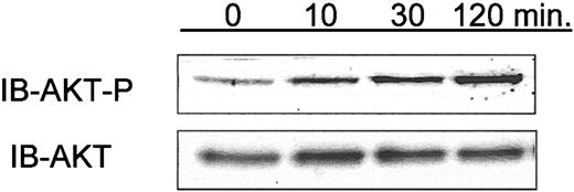 Figure 7. Phosphorylation of AKT in CLL cells isolated from patients who have received intravenous Hu1D10 for the treatment of CLL. In conjunction with a clinical trial of Hu1D10, blood samples were obtained at pretreatment and 10, 30, and 120 minutes following the infusion of Hu1D10. Following density gradient isolation of lymphocytes, whole cell lysates were made and analyzed using immunoblots to determine relative changes in phosphorylated AKT (Ser473). Samples from 3 patients were tested. For 2 of 3 patients, samples showed a sustained rise in phospho-AKT following Hu1D10 treatment. Data shown here are representative of these 2.
