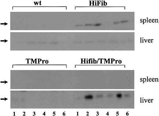 Figure 2. Deposition of cross-linked fibrin in tissues of hyperfibrinogenemic mice. Equivalent amounts (normalized to initial wet tissue weight) of the urea-insoluble fraction of tissue extracts from wild-type (wt), thrombomodulin-deficient (TMPro), and hyperfibrinogenemic mice (Hifib and Hifib/TMPro) were subjected to SDS-PAGE (sodium dodecyl sulfate–polyacrylamide gel electrophoresis), and the fibrin β-chain (arrows) was detected with fibrin-specific antibodies recognizing the neoepitope generated by thrombin-mediated fibrinopeptide B release. Each lane represents analysis of one organ from one mouse; 6 lanes per mouse strain shown. Total protein content loaded in each lane was roughly equivalent, as ascertained by Poinceau S staining of blots (not shown). Excess fibrin is found only in the spleen of Hifib mice and not in other organs, including liver. Mice with combined hyperfibrinogenemia and thrombomodulin-deficiency (Hifib/TMPro) show excess fibrin in the liver but not in the spleen or other organs (heart, lung, kidney, brain not shown).