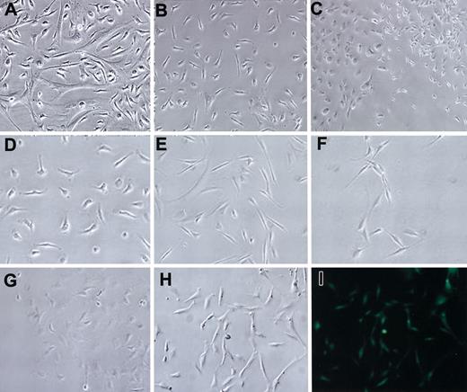 Figure 2. Morphologies of mMSCs. mMSCs from Bl/6 mice: (A) passage 0, (B) passage 1, and (C) passage 5. Low-density plating to show the morphology of passage 7 mMSCs from the mouse strains: (D) Bl/6, (E) BALB/c, (F) FVB/N, (G) DBA1, and passage 4 GFPtg, phase contrast (H) and epifluorescence (I). Original magnification, × 10.