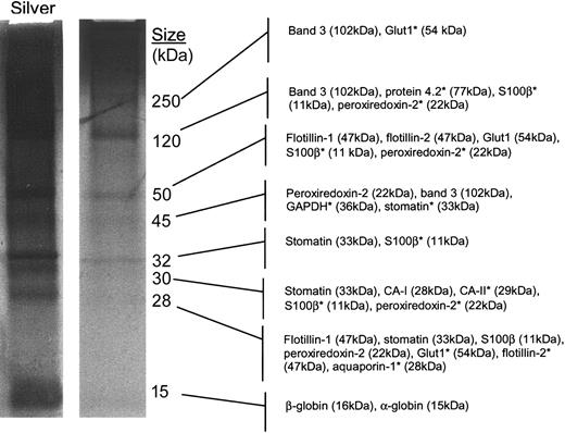 Figure 4. Major erythrocyte raft components include band 3, the flotillins, and stomatin. Detergent-resistant membrane fractions were prepared from normal human erythrocytes. Membranes were purified, extracted in 1% cold Tx-100, and subjected to sucrose density gradient centrifugation for 18 hours as described in “Materials and methods.” The raft-containing fraction was dialyzed, dried, TCA precipitated, dried, and resuspended. The purified fraction was separated by reducing SDS-PAGE and stained with collodial Coomassie or silver. Structural analyses were performed on excised Coomassie-stained protein bands using a nanocapillary reverse-phase column coupled to a ThermoFinnigan LCQ Classic quadrupole ion trap mass spectrometer. Resulting masses and MS/MS data were searched against the nonredundant NCBI database to make the listed protein predictions. *Tentative predictions.