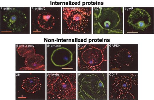 Figure 6. DRM association is necessary but not sufficient to target host proteins to the malarial vacuolar membrane. Normal human erythrocytes were infected with asexual stage P falciparum. Infected cultures were sampled and prepared for indirect immunofluorescence assays. Cells were adhered to 0.1% poly-l-lysine–coated glass coverslips, fixed, washed, and permeabilized before treatments with appropriate primary and fluorescein- or rhodamine-conjugated secondary antibodies. Hoechst stain was used to visualize parasite nuclei. Fluorescence microscopy images were obtained using DeltaVision deconvolution microscopy (Applied Precision, Seattle, WA) as previously described.1 Images are single optical sections of cells infected with ring-stage parasites. Scale bars present size (in μm). All images were obtained with a 100 × objective.