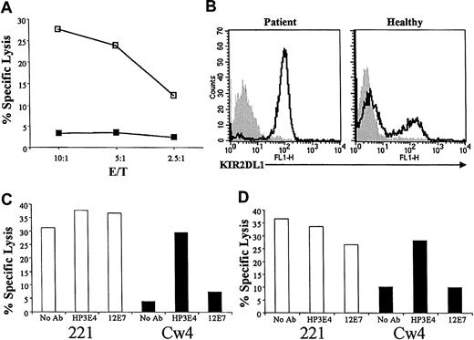 Figure 1. KIR2DL1 is expressed on all NK cells derived from the patient. (A) Bulk NK cultures derived from the patient were incubated with 721.221 targets (221; □), or with 721.221 transfected with HLA-Cw4 (Cw4; ▪), at the indicated effector-target (E/T) ratios. (B) Fluorescence-activated cell sorter (FACS) analysis for KIR2DL1 expression of bulk NK cultures derived from the patient (left) and a representative healthy donor (right) using the EB6 mAb. Staining (open histograms) is shown overlaid on background (shaded histograms). The NK cells were incubated for one hour with or without anti-KIR2DL1 mAb HP3E4 or the anti-CD99 mAb 12E7 and then tested against the various targets as in panel A. Shown is a representative NK clone (C) and NK bulk cultures (D), both derived from the patient.