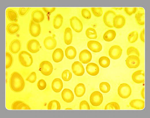 • Stanley Schrier, Stanford University School of Medicine