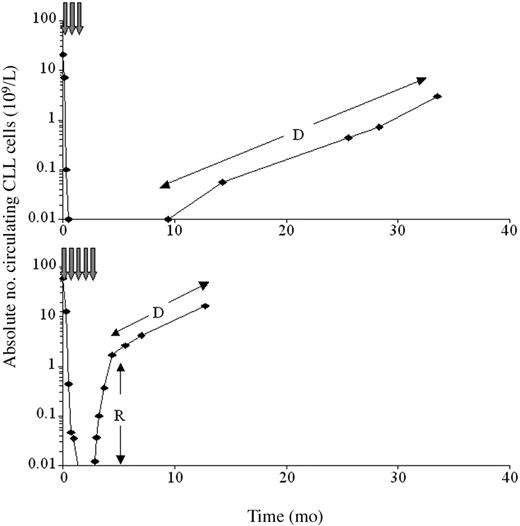 Figure 2. The kinetics of peripheral disease progression after treatment are biphasic in many patients. The figure shows the absolute peripheral blood CLL cell count (logarithmic scale) for a responding patient (top) and a nonresponding patient (bottom). In many nonresponders, there was an initial period of rapidly increasing peripheral CLL cell levels (R), presumably reflecting redistribution of tumor from bone marrow or lymph nodes. This stabilized to show the true rate of progression (D) approximately 2 months after cessation of therapy. In the responding patient, disease levels could be monitored prior to clinical relapse for a period of approximately 2 years from first detection.