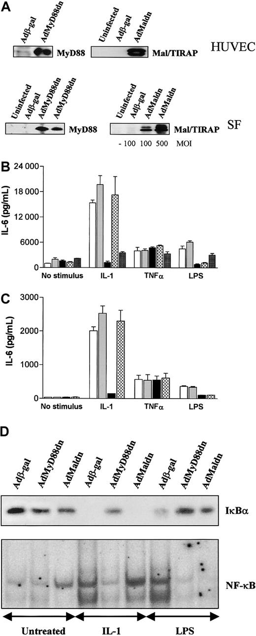 Figure 5. MyD88dn and Maldn block LPS-induced NF-κB activation and cytokine production in human SFs and HUVECs. SFs and HUVECs were infected with adenoviruses overexpressing β-galactosidase, MyD88dn, Maldn, or MalTIR in serum-free medium. Then cells were cultured in complete medium for another day. (A) Cells were examined for the expression of MyD88dn and Maldn. SFs (B) and HUVECs (C) were treated with 20 ng/mL IL-1, 1 μg/mL LPS, or 20 ng/mL TNFα for 20 hours, and supernatants from uninfected (white bars), Adβ-gal– (gray bars), AdMyD88dn- (black bars), AdMaldn- (cross-hatched bars), or AdMalTIR-infected (checkered bars) cells were assayed by ELISA for IL-6. Mean cytokine production (± SD) of triplicate cultures is shown and is representative of 5 independent experiments from unrelated donors. (D) SFs were stimulated for 45 minutes with 20 ng/mL IL-1, or 1 μg/mL LPS; cytosolic and nuclear extracts were collected and then examined for IκBα expression by Western blot (upper panel) and NF-κB DNA binding by EMSA (lower panel).