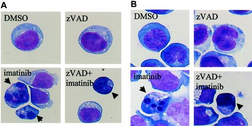 Figure 2. Imatinib induces classical apoptosis, while zVAD + imatinib induces atypical cell death. Diff-Quick–stained cytocentrifuge specimens of BV173 cells (A) and K562 cells (B). BV173 cells and K562 cells were treated for 12 hours and 48 hours, respectively, with DMSO, zVAD, imatinib, and zVAD + imatinib. After treatment with imatinib, BV173 cells and K562 cells exhibited cell shrinkage, nuclear condensation, and nuclear fragmentation, which are characteristic of apoptosis. In contrast, after treatment of zVAD + imatinib, BV173 cells and K562 cells exhibited cell shrinkage, nonfragmented nuclei, and marked cellular pyknosis. Results are representative of 5 individual experiments. Arrows indicate apoptotic cells; arrowheads, atypical cells. Original magnification, × 1000.