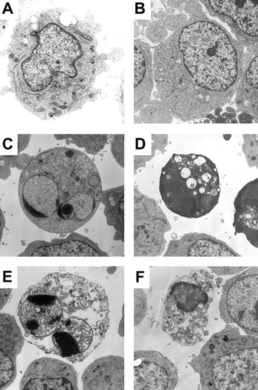 Figure 3. Atypical cell death exhibited necrotic morphology by ultrastructural examination. BV173 cells were treated with DMSO (A), zVAD (B), imatinib (C, E), and zVAD + imatinib (D, F) for 12 hours (A-D) and 48 hours (E-F). Specimens were prepared for transmission electron microscopy as described in “Materials and methods.” Results are representative of 3 individual experiments. Original magnification, × 3000.