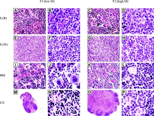Figure 5. Histologic analysis of target tissues from mice segregating the splenomegaly phenotype. Spleen (S) (R indicates red pulp; W, white pulp), bone marrow (BM) and lymph nodes (LN) from (BALB/cJ × BXH-2)F2 mice showing presence (high SI) or absence (low SI) of splenomegaly were harvested, fixed, sectioned, and stained with hematoxylin and eosin. Original magnification was × 40 (M,O), × 400 (A,C,E,G,I,K), and × 1000 (B,D,F,H,J,L,N,P). Important infiltration of cells with neutrophil-like appearance with “ring” nuclei is seen in red pulp of the spleen, bone marrow, and in enlarged lymph nodes of F2 mice showing splenomegaly.