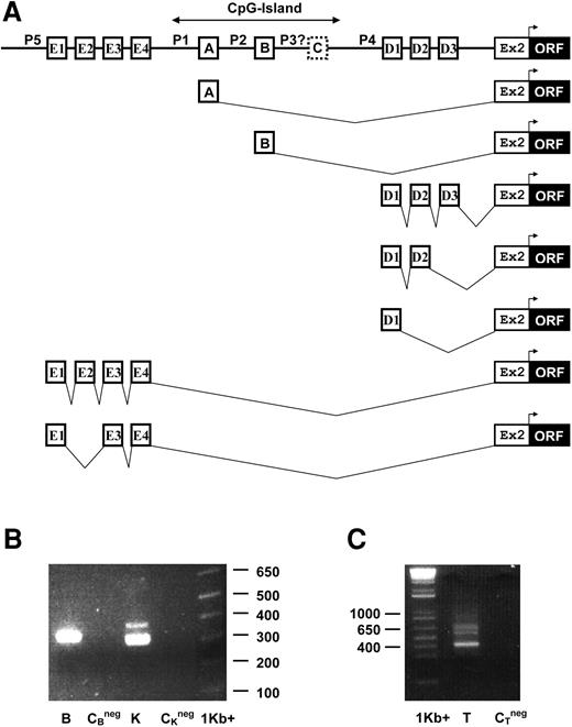 Figure 1. Genomic structure of the promoter region of human AC133 and alternative splicing within its 5′-UTR. (A) Exon 1A, exon 1B, exons D1, D2, and D3 from cluster 1D, and exon E4 from cluster 1E are alternatively spliced to a common exon 2, according to our RACE data. Translation initiation site is located in exon 2. 5′-RACE revealed the presence of exons 1A, 1B, and exon clusters 1D and 1E, while exon 1C was found as a single EST from skeletal muscle. P1, P2, P4, P5, and possibly P3 are alternative promoters for the AC133 gene. Exons 1A, 1B, 1C, and their corresponding promoters are located within a CpG island. (B) 5′-RACE analysis of AC133 mRNA. mRNAs from brain (B) and kidney (K) were subjected to 5′-RACE analysis. The PCR products (second round of amplification; nested primers) were resolved on 1.5% agarose gel, stained with ethidium bromide. Size marker 1 kb plus is shown on the right (1 kb+). CBneg and CKneg are negative controls for brain and kidney, respectively. One band from brain and 2 bands from kidney were isolated, subcloned into pCR4-TOPO, and sequenced. The band from brain was found to comprise exon 1B fragments. The lower band from kidney was found to comprise a majority of exon 1A fragments, with a minority of exon 1B fragments. The upper band from kidney was found to comprise exon 1A fragments from an alternate transcription start point, 55 bp longer than those in the lower band. (C) 5′-RACE analysis of AC133 mRNA in testis (T). Multiple bands were observed for testis 5′-RACE products. Since multiple bands were observed, the entire pool of PCR products was subcloned into pCR4-TOPO directly from the PCR product mix. PCR mix was determined to contain 5 different alternative splice variants containing exons from either cluster 1E or cluster 1D.