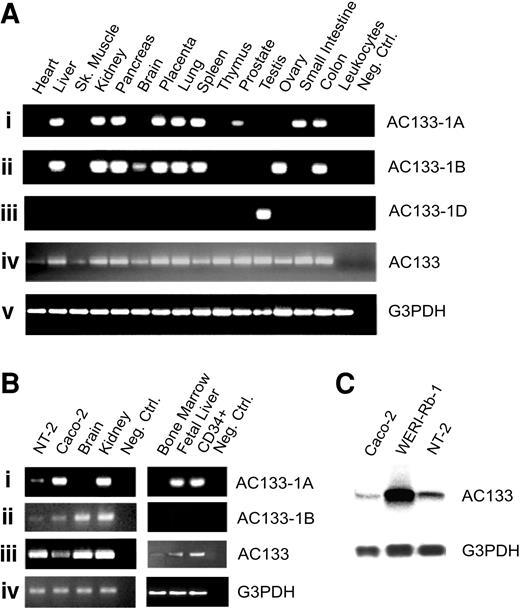 Figure 2. Tissue distribution of different 5′-UTR isoforms of AC133 mRNA. AC133 isoforms were amplified by PCR and separated on a 2% agarose gel stained with ethidium bromide. Panels Aiv and Biii show expression of AC133 by RT-PCR with primers located in the 3′ distal exons common to all known AC133 isoforms in indicated tissues or cell lines. (A) Expression of exon 1A, exon 1B, and exon 1D containing isoforms of AC133 mRNA in human adult tissues is represented in panels Ai and Aii. (B) Expression of exon 1A–, exon 1B–, and exon 1D–containing isoforms of AC133 mRNA in human brain, kidney, bone marrow, fetal liver, CD34+ cord blood cells, and cell lines Caco-2 and NT-2 are represented in panels Bi and Bii. Results are consistent in at least 3 independent PCR reactions. (C) Northern blot analysis of total RNA isolated from Caco-2, WERI-Rb-1, and NT-2 cell lines. Equal amounts of RNA (20 μg) were loaded in each lane. Blot was hybridized with a 32P-labeled probe for human AC133 mRNA. Size positions of RNA ladder are indicated on the right side. A 32P-labeled probe for human glyceraldehyde 3–phosphate dehydrogenase (G3PDH) was included as an internal control for loading and is shown in the bottom line.