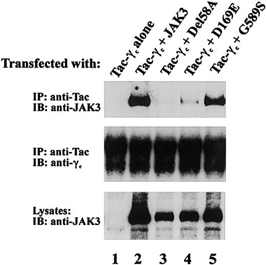 Figure 5. Effects of patient JAK3 mutations on JAK3/γc association. COS-7 cells were transfected with 5 μg of the indicated cDNAs. Cell lysates were immunoprecipitated with anti-Tac antibody and blotted with an anti-Jak3 antibody (top blot) or anti-γc (middle blot). Lysates were also blotted with anti-JAK3 Ab (bottom blot) to assess expression of the various JAK3 proteins.