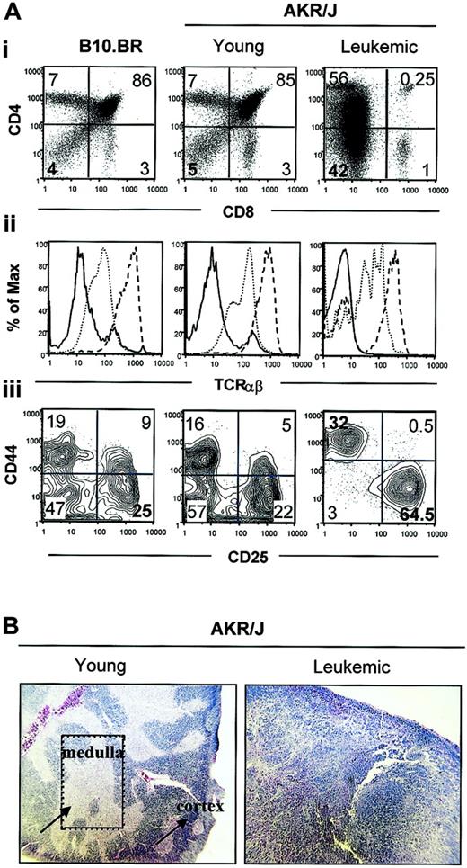 Figure 1. Abnormal early T-cell compartment in leukemic AKR/J mice. (A) Thymus from leukemic (6 months) and young (2 months) AKR/J mice were characterized by FACS analysis in comparison to control B10.BR thymocytes. Numbers shown in FACS profiles denote percentages of cells in each quadrant. Thymocytes were analyzed with 3-color staining by using anti-CD4–PE, anti-CD8–FITC, and anti-TCRαβ–-Cy (i-ii). FACS profiles (i) show analysis of CD4 versus CD8 distribution in total thymocytes. Histograms profiles (ii) show level expression of TCRαβ among gated DN (solid line) versus DP (thin dashed line) and CD4+ SP (thick dashed line) thymocytes. CD44 versus CD25 distribution (iii) was analyzed among gated DN thymocytes by 4-color staining using anti-CD4–PE, anti-CD8–FITC, anti-CD25–APC, and anti-CD44–Cy antibodies. (B) Thymus isolated from leukemic (6 months) and young (2 months) AKR/J mice were examined by hematoxylin and eosin staining. Dark areas represent thymic cortex, whereas light areas show thymic medulla. Results (A-B) are representative of 3 independent experiments with n = 3 mice for each experiment. Original magnification × 40.