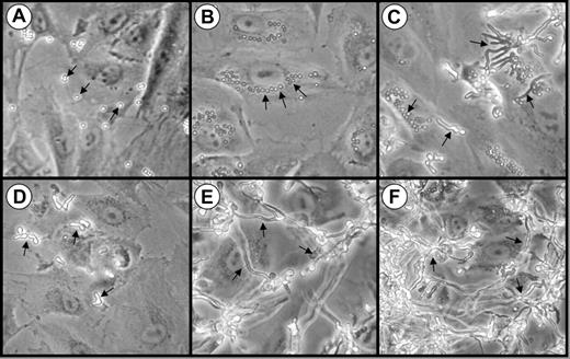 Figure 1. Interactions of A fumigatus conidia and germ tubes with endothelial cells. Photomicrographs of endothelial cell monolayers infected with A fumigatus H237 conidia (A-C) and germ tubes (D-F) after 30 minutes (A,D), 3 hours (B,E), and 8 hours (C,F). Original magnification × 20. Arrows indicate the organisms.