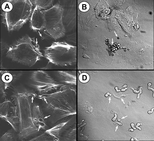Figure 3. Confocal microscopy of actin filaments surrounding endocytosed organisms. Endothelial cells were incubated for 45 minutes with A fumigatus H237 conidia (A-B) or germ tubes (C-D), and then stained for filamentous actin. (A,C) Confocal images of the filamentous actin. (B,D) Differential interference contrast images of the same microscopic fields shown in panels A and C, respectively. Arrows indicate endothelial cell actin polymerizing around the organisms (A,C) and the organisms themselves (B,D). Original magnification × 1000.