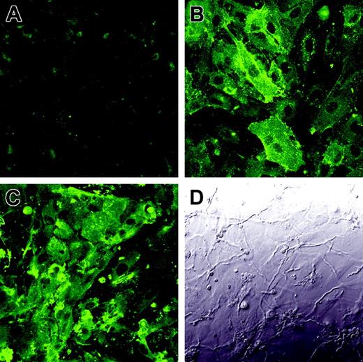 Figure 7. Expression of tissue factor on the surface of infected endothelial cells. Endothelial cell monolayers grown on glass coverslips were incubated for 8 hours with tissue culture medium (A), LPS (B), or germ tubes of A fumigatus (C-D). The expression of tissue factor on the endothelial cell surface was detected by confocal microscopy using an anti–tissue factor monoclonal antibody (A,C). Panel D shows the differential interference contrast image corresponding to the same field as panel C. Results are representative of 3 independent experiments. Original magnification × 400.