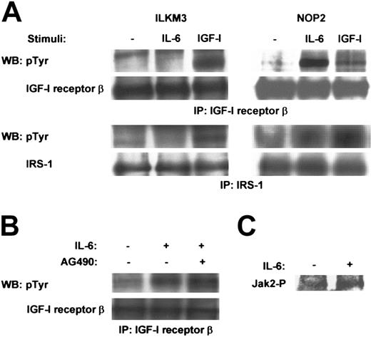 Figure 5. IL-6 induced the tyrosine phosphorylation of IGF-I receptor β in NOP2 but not in ILKM3. (A) Immunoprecipitation (IP) and Western blot (WB) analysis with the indicated antibodies showed tyrosine phosphorylation of IGF-I receptor β and IRS-1 in ILKM3 and NOP2 treated with or without IL-6 (2 ng/mL) or IGF-I (100 ng/mL) for 5 minutes. (B) A Jak2 inhibitor, AG490 (20 μM), had no effect on the IL-6–induced phosphorylation of IGF-I receptor β in NOP2. (C) IL-6 (2 ng/mL) activated Jak2 in NOP2, as shown by IP-Western analysis using a phospho-specific Jak2 antibody.