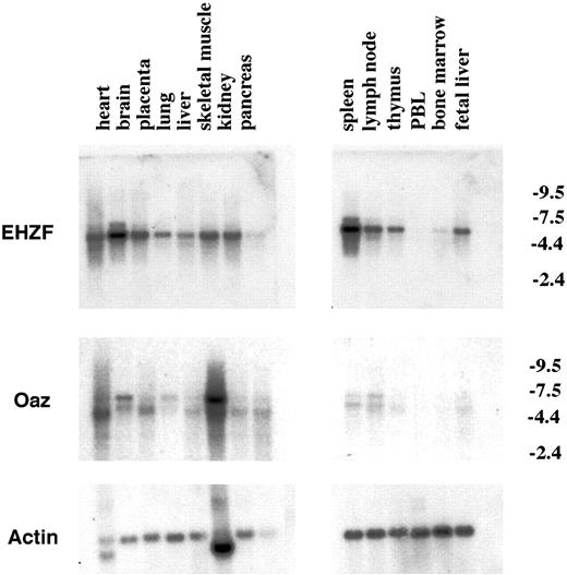 Figure 3. Expression of the EHZF mRNA in human tissues. Northern blots from Clontech containing 5 μg polyA+ mRNA from different human tissues were hybridized sequentially with probes for EHZF (exposed for 5 days), OAZ (exposed for 10 days), and then actin (exposed for 24 hours). The migration of the major EHZF band corresponds to a size of approximately 5.5 kb, consistent with that observed in CD34+ cells and hematopoietic cell lines. Numbers on the right indicate kb.