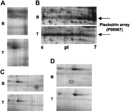 Figure 3. Close-up images of representative 2-DE gel images showing changes in signaling proteins that have been identified by differential analysis. (A) ILK-2. (B) Pleckstrin. (C) RKIP. (D) RGS10. B indicates 2-DE gel corresponding to basal platelets; and T, 2-DE gel corresponding to TRAP-activated platelets (5 μM, 30 s). Circled areas indicate the differentially regulated protein feature.