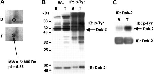 Figure 5. Dok-2 tyrosine phosphorylation induced by TRAP. (A) 2-DE gel representative image showing up-regulation of a Dok-2 protein feature upon TRAP stimulation. (B) Whole protein lysate and phosphotyrosine immunoprecipitated proteins or (C) Dok-2 immunoprecipitated proteins were separated by SDS-PAGE and immunoblotted using 4G10 antiphosphotyrosine or anti–Dok-2 antibodies. B indicates basal; T, TRAP (5 μM, 30 s); IP, immunoprecipitation; and IB, immunoblot. Images represent at least 3 independent experiments.