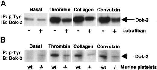 Figure 6. Dok-2 tyrosine phosphorylation induced by activation of thrombin and collagen receptors. Role of outside-in signaling via the integrin αIIbβ3. Phosphotyrosine immunoprecipitated proteins from human (A) or murine (B) platelets were separated by SDS-PAGE and immunoblotted using anti–Dok-2 antibodies. Platelets were activated with thrombin (1.0 U/mL, 90 seconds), convulxin (3 μg/mL, 2 minutes), and collagen (10 μg/mL, 2.5 minutes). (A) Platelets were activated in the presence or absence of the αIIbβ3 antagonist lotrafiban (10 μM). (B) Wt indicates wild-type mice; –/–, αIIb-deficient mice; IP, immunoprecipitation; and IB, immunoblot. Images represent at least 3 independent experiments.