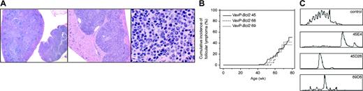 Figure 1. VavP-Bcl2 transgenic mice develop follicular lymphoma. (A) Histopathology of lymphoma in a 335-day-old VavP-Bcl2 45 mouse, which had massive enlargement of the spleen and lymph nodes and extensive infiltration of the liver and kidneys. Low-power (× 10) views of spleen and a lymph node (left) show nodular and diffuse infiltration, and a section of the liver (middle) with extensive infiltrates in the portal tract. High-power (× 100) view of the tumor tissue (right) shows centrocytes, with their small, darkly stained nuclei, among the larger centroblasts with their typical vesicular nucleus containing a prominent nucleolus and dispersed chromatin. (B) Cumulative incidence of follicular lymphoma in VavP-Bcl2 transgenic mice. A total of 69, 40, and 49 mice of strains 45, 68, and 69, respectively, were monitored up to 18 months of age. Follicular lymphoma was diagnosed from histology of enlarged lymphoid organs of sick mice. The incidence in each strain was determined by censoring all cases of other disease at the time of occurrence, as well as any mice removed for analysis. There were no significant differences among the 3 strains by log-rank test (chi-square = 0.651; P = .722). (C) Rearranged immunoglobulin VDJ sequences were amplified as described in “Materials and methods” and analyzed at high resolution in an automated sequencer. Control B cells sorted from healthy C57BL/6 spleen yielded, as expected, multiple clusters of bands separated by 3 base pairs. The 3 lower panels show VDJ genes from individual follicular lymphomas, each yielding a single predominant band indicative of clonality.
