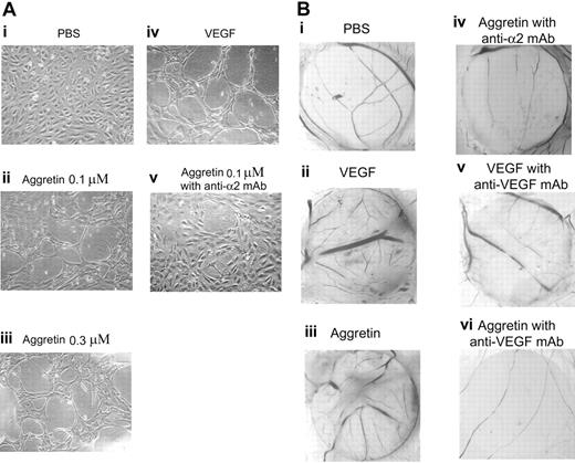 Figure 2. Effect of aggretin on Matrigel capillary tube formation and angiogenesis in the chick CAM model. (A) HUVECs (2 × 105/well) were treated either in the absence (PBS control, i) or in the presence of VEGF (30 ng/mL, iv); in the presence of aggretin (0.1 μM, ii; or 0.3 μM, iii); or preincubated with anti–integrin α2 mAb, A2-IIE10, for 30 minutes, then treated in presence of aggretin (0.1 μM, v), and then plated on diluted Matrigel (4 mg/mL) for 24 hours. After washing and fixation, cells were observed under microscope at × 40 magnification and photographed. A representative one of 4 similar experiments is shown. (B) CAMs of 10-day-old chick embryos were incubated with vehicle (PBS, i), VEGF (200 ng/disk, ii), aggretin (0.6 μg/disk, iii), or compounds in combination with A2-IIE10 (50 μg/mL, iv) or VEGF mAb (1 μg/mL, v-vi) for 48 hours, and then resected, fixed, and photographed with a stereomicroscope at × 10 magnification. A representative one of 3 similar results is shown.