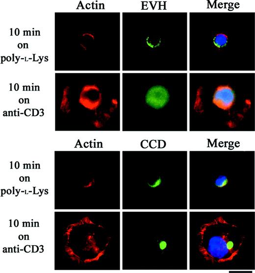 Figure 3. Nuclear translocation of EVH1 domain fragment in Jurkat cells stimulated with anti-CD3 antibody. Jurkat cells were electroporated with Myc construct expressing EVH1 domain or coiled-coil domain (CCD) fragment of Homer-3. Twenty-four hours later, the cells were incubated for 10 minutes at 37°Con glass slides coated with poly-l-lysine only or poly-l-lysine and OKT3 and then stained with anti-Myc antibody. Both fragments were detected in the cytoplasmic region after incubation on poly-l-lysine–coated glass slides. After stimulation with OKT3, the EVH1 domain fragment was detected in the nucleus, whereas the CCD fragment formed cytoplasmic aggregates. Representative images were presented from experiments performed at least 3 times. Bars, 10 μm.