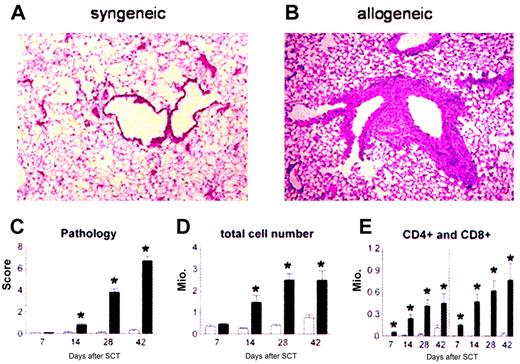 Figure 1. Recruitment of donor effector cells to the lungs after BMT. Donor T cells and monocytes/macrophages are recruited to the lung and cause lung injury after allogeneic BMT. B6D2F1 mice received allogeneic (▪) or syngeneic (□) BM transplants, and lungs were examined at weeks 1, 2, 4, and 6 as described in “Patients, materials, and methods.” Photomicrographs (original magnification, × 200) from hematoxylin-eosin–stained sections obtained 6 weeks after syngeneic (panel A) or allogeneic (panel B) BMT. Recipients of allogeneic BM transplants develop significant lung pathology compared with syngeneic controls as determined with a semiquantitative scoring system (panel C). Total BAL fluid cellularity (panel D) and T-cell counts (panel E) correlate with histologic changes. Data are from 2 experiments representative of 3 and are presented as mean ± SEM; n = 8 to 10 per group per time point; *P < .01.