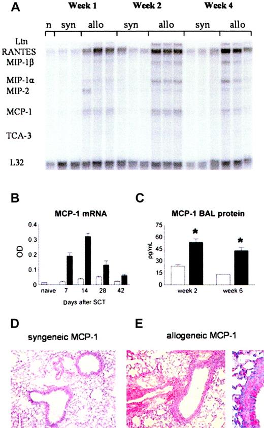 Figure 2. Increase in MCP-1 levels in the lung after allogeneic BMT. Animals received allogeneic (▪) or syngeneic (□) BM transplants as in Figure 1. (A) MCP-1 mRNA expression was determined after BMT by RNAase protection assay. (B) MCP-1 expression is increased after allogeneic BMT compared with syngeneic controls at all time points. (C) BALF protein levels of MCP-1 (ELISA) are increased at week 2 and week 6 after allogeneic BMT. Data are presented as mean ± SEM; n = 3 to 10 animals per group; *P < .01. (D-E) Immunohistochemical alkaline phosphatase staining for MCP-1 in lungs from syngeneic (left) and allogeneic (right) BM transplant recipients 14 days after transplantation. Original magnifications: × 200 (D); × 400 (E).