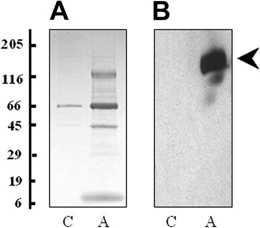 Figure 1. Proteins released by platelets following thrombin activation. (A) The proteins from the supernatant of nonactivated (C) and thrombin-activated platelets (A) were solubilized in SDS reducing buffer, separated by one-dimensional SDS-PAGE (4%-20% gradient gel) and stained with colloidal Coomassie blue. (B) A duplicate of the gel was probed with a monoclonal antibody to thrombospondin (clone p10). Molecular weight markers are indicated.